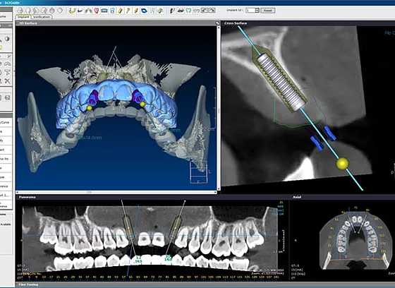 Invivo dental viewer download